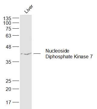 Rat Liver lysates probed with Nucleoside Diphosphate Kinase 7 Polyclonal Antibody, Unconjugated (bs-19504R) at 1:300 dilution and 4˚C overnight incubation. Followed by conjugated secondary antibody incubation at 1:20000 for 60 min at 37˚C.