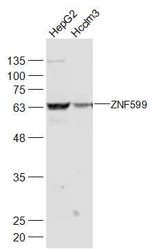 Lane 1: HepG2 cell lysates; Lane 2: Hcclm3 cell lysates probed with ZNF599 Polyclonal Antibody, Unconjugated (bs-19530R) at 1:300 dilution and 4˚C overnight incubation. Followed by conjugated secondary antibody incubation at 1:20000 for 60 min at 37˚C.