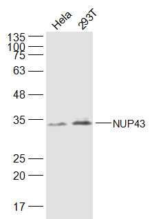 Lane 1: Hela cell lysates; Lane 2: 293T cell lysates probed with NUP43 Polyclonal Antibody, Unconjugated (bs-19545R) at 1:500 dilution and 4˚C overnight incubation. Followed by conjugated secondary antibody incubation at 1:20000 for 60 min at 37˚C.