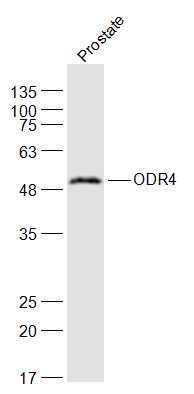 Rat prostate lysates probed with ODR4 Polyclonal Antibody, Unconjugated (bs-19564R) at 1:1000 dilution and 4˚C overnight incubation. Followed by conjugated secondary antibody incubation at 1:20000 for 60 min at 37˚C.