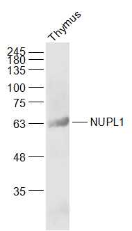 Rat thymus lysates probed with NUPL1 Polyclonal Antibody, Unconjugated (bs-19569R) at 1:1000 dilution and 4˚C overnight incubation. Followed by conjugated secondary antibody incubation at 1:20000 for 60 min at 37˚C.