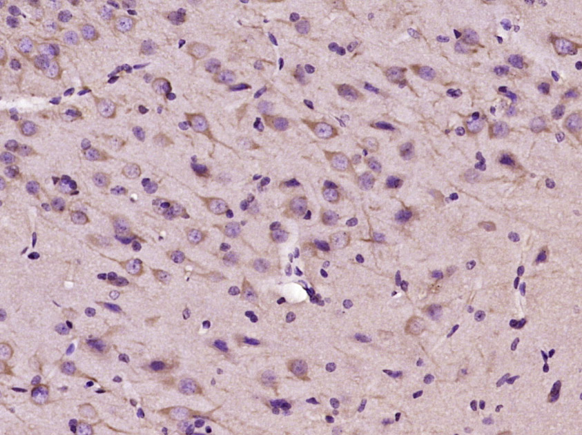 Paraformaldehyde-fixed, paraffin embedded Rat brain; Antigen retrieval by boiling in sodium citrate buffer (pH6.0) for 15min; Block endogenous peroxidase by 3% hydrogen peroxide for 20 minutes; Blocking buffer (normal goat serum) at 37°C for 30min; Antibody incubation with WNT4 Polyclonal Antibody, Unconjugated (bs-6134R) at 1:400 overnight at 4°C, DAB staining.