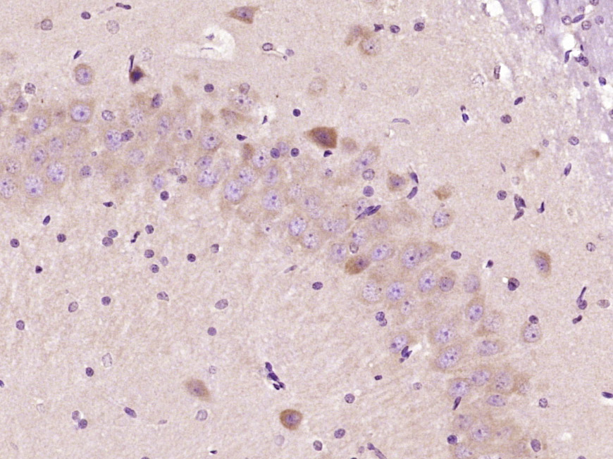 Paraformaldehyde-fixed, paraffin embedded Rat brain; Antigen retrieval by boiling in sodium citrate buffer (pH6.0) for 15min; Block endogenous peroxidase by 3% hydrogen peroxide for 20 minutes; Blocking buffer (normal goat serum) at 37°C for 30min; Antibody incubation with FUT10 Polyclonal Antibody, Unconjugated (bs-16197R) at 1:400 overnight at 4°C, DAB staining.