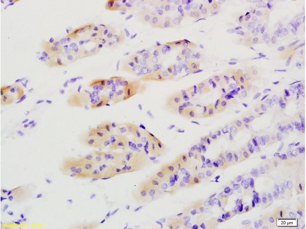Formalin-fixed and paraffin embedded mouse stomach tissue labeled with Anti-Tenascin C/Tn-C Polyclonal Antibody, Unconjugated (bs-1039R) at 1:200 followed by conjugation to the secondary antibody and DAB staining\n