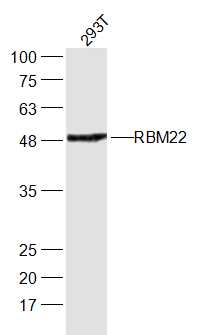 293T cell lysates probed with RBM22 Polyclonal Antibody, Unconjugated (bs-19767R) at 1:300 dilution and 4˚C overnight incubation. Followed by conjugated secondary antibody incubation at 1:20000 for 60 min at 37˚C.