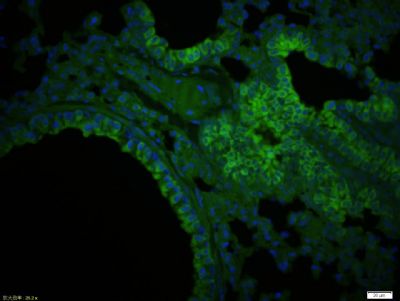 Paraformaldehyde-fixed, paraffin embedded Mouse lung; Antigen retrieval by boiling in sodium citrate buffer (pH6.0) for 15min; Blocking buffer (normal goat serum) at 37°C for 30min; Antibody incubation with CTRP5 Polyclonal Antibody, Unconjugated (bs-11717R) at 1:200 overnight at 4°C, followed by a conjugated Goat Anti-Rabbit IgG antibody (bs-0295G-FITC) for 90 minutes, and DAPI for nuclei staining.