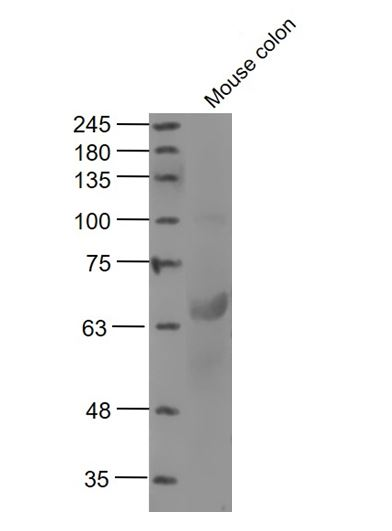 Lane 1: Mouse Colon; Probed with MTM1 Polyclonal Antibody, unconjugated (bs-9178R) at 1:500 overnight at 4°C followed by a conjugated secondary antibody for 60 minutes at 37°C.