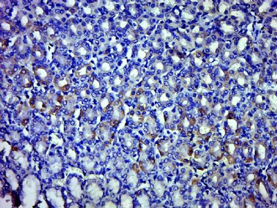 Paraformaldehyde-fixed, paraffin-embedded Rat stomach; Antigen retrieval by boiling in sodium citrate buffer (pH6.0) for 15min; Block endogenous peroxidase by 3% hydrogen peroxide for 20 minutes; Blocking buffer (normal goat serum) at 37°C for 30min; Antibody incubation with FAM108A1 Polyclonal Antibody, Unconjugated (bs-14691R) at 1:500 overnight at 4°C, followed by a conjugated secondary for 20 minutes and DAB staining.