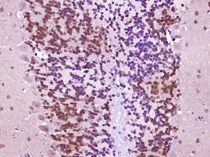 Paraformaldehyde-fixed, paraffin embedded Mouse brain; Antigen retrieval by boiling in sodium citrate buffer (pH6.0) for 15min; Block endogenous peroxidase by 3% hydrogen peroxide for 20 minutes; Blocking buffer (normal goat serum) at 37°C for 30min; Antibody incubation with FOX3/NeuN Polyclonal Antibody, Unconjugated (bs-1613R) at 1:400 overnight at 4°C, DAB staining.