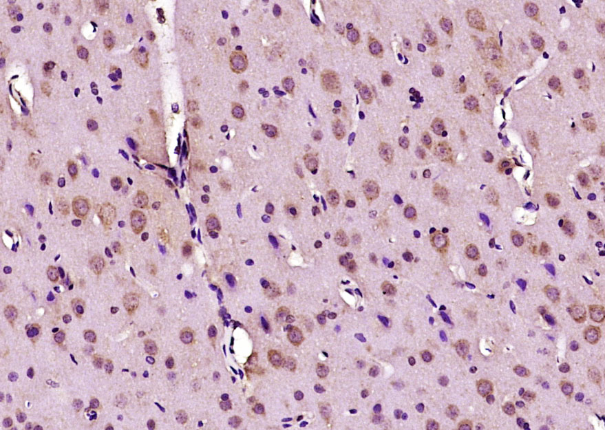 Paraformaldehyde-fixed, paraffin embedded Rat brain; Antigen retrieval by boiling in sodium citrate buffer (pH6.0) for 15min; Block endogenous peroxidase by 3% hydrogen peroxide for 20 minutes; Blocking buffer (normal goat serum) at 37°C for 30min; Antibody incubation with Doublecortin (Ser47) Polyclonal Antibody, Unconjugated (bs-3113R) at 1:400 overnight at 4°C, DAB staining.