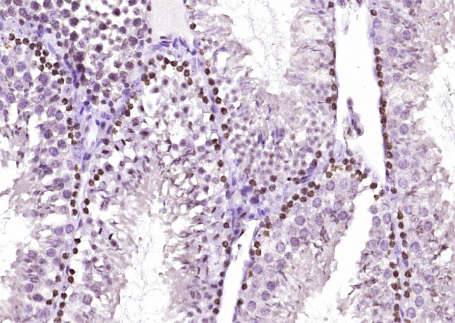 Paraformaldehyde-fixed, paraffin embedded Mouse testis; Antigen retrieval by boiling in sodium citrate buffer (pH6.0) for 15min; Block endogenous peroxidase by 3% hydrogen peroxide for 20 minutes; Blocking buffer (normal goat serum) at 37°C for 30min; Antibody incubation with Smad2(Ser465 + Ser467) Polyclonal Antibody, Unconjugated (bs-3419R) at 1:400 overnight at 4°C, DAB staining.