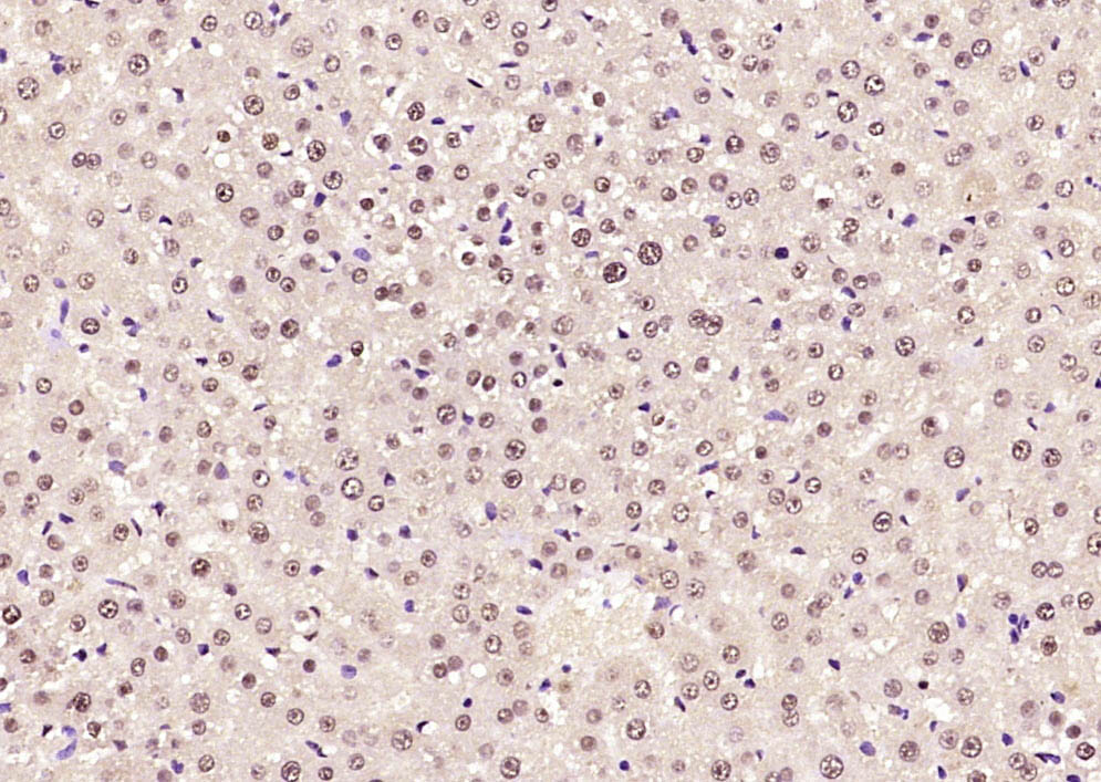 Paraformaldehyde-fixed, paraffin embedded Rat liver; Antigen retrieval by boiling in sodium citrate buffer (pH6.0) for 15min; Block endogenous peroxidase by 3% hydrogen peroxide for 20 minutes; Blocking buffer (normal goat serum) at 37°C for 30min; Antibody incubation with SOX9 Polyclonal Antibody, Unconjugated (bs-10725R) at 1:400 overnight at 4°C, DAB staining.