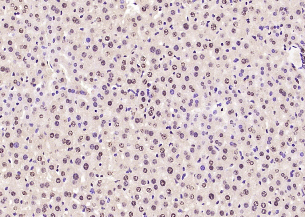 Paraformaldehyde-fixed, paraffin embedded Mouse liver; Antigen retrieval by boiling in sodium citrate buffer (pH6.0) for 15min; Block endogenous peroxidase by 3% hydrogen peroxide for 20 minutes; Blocking buffer (normal goat serum) at 37°C for 30min; Antibody incubation with SOX9 Polyclonal Antibody, Unconjugated (bs-10725R) at 1:400 overnight at 4°C, DAB staining.