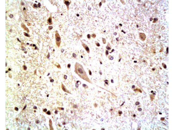 Formalin-fixed and paraffin embedded: rat spinal cord tissue labeled with Anti-Neurofascin Polyclonal Antibody, Unconjugated (bs-0289R) at 1:200, followed by conjugation to the secondary antibody and DAB staining