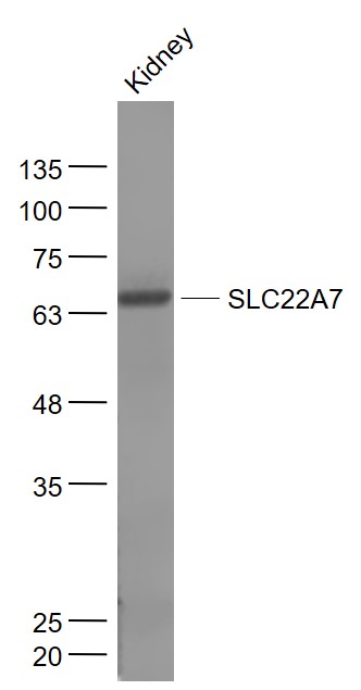 Mouse kidney lysates probed with SLC22A7 Polyclonal Antibody, Unconjugated (bs-19808R) at 1:300 dilution and 4˚C overnight incubation. Followed by conjugated secondary antibody incubation at 1:20000 for 60 min at 37˚C.