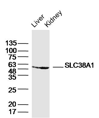 Lane 1: Mouse liver lysates; Lane 2: Mouse kidney lysates probed with SLC38A1 Polyclonal Antibody, Unconjugated (bs-19825R) at 1:300 dilution and 4˚C overnight incubation. Followed by conjugated secondary antibody incubation at 1:20000 for 60 min at 37˚C.