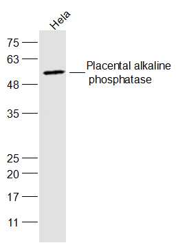 Hela cell lysates probed with Placental alkaline phosphatase Polyclonal Antibody, Unconjugated (bs-20015R) at 1:300 dilution and 4˚C overnight incubation. Followed by conjugated secondary antibody incubation at 1:20000 for 60 min at 37˚C.