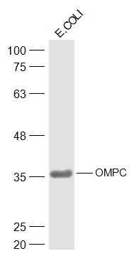 E.COLI lysates probed with OMPC Polyclonal Antibody, Unconjugated (bs-20213R) at 1:300 dilution and 4˚C overnight incubation. Followed by conjugated secondary antibody incubation at 1:20000 for 60 min at 37˚C. E.COLI lysates probed with OMPC Polyclonal Antibody, Unconjugated (bs-20213R) at 1:300 dilution and 4˚C overnight incubation. Followed by conjugated secondary antibody incubation at 1:20000 for 60 min at 37˚C.