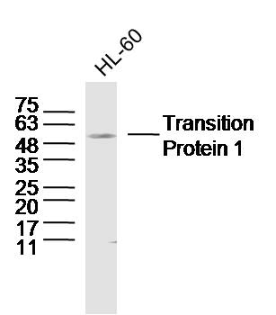 HL-60 cell lysates probed with Transition Protein 1 Polyclonal Antibody, Unconjugated (bs-20307R) at 1:300 dilution and 4˚C overnight incubation. Followed by conjugated secondary antibody incubation at 1:20000 for 60 min at 37˚C.