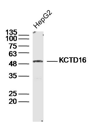 HepG2 cell lysates probed with KCTD16 Polyclonal Antibody, Unconjugated (bs-20315R) at 1:300 dilution and 4˚C overnight incubation. Followed by conjugated secondary antibody incubation at 1:20000 for 60 min at 37˚C.