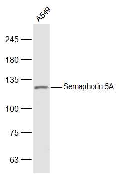 A549 cell lysates probed with Semaphorin 5A Polyclonal Antibody, Unconjugated (bs-20430R) at 1:500 dilution and 4˚C overnight incubation. Followed by conjugated secondary antibody incubation at 1:20000 for 60 min at 37˚C.