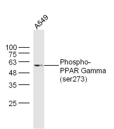Lane 1: A549 Cell lysates; Probed with PPAR Gamma (Ser273) Polyclonal Antibody, unconjugated (bs-4888R) at 1:300 overnight at 4°C followed by a conjugated secondary antibody for 60 minutes at 37°C.