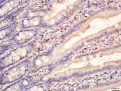 Paraformaldehyde-fixed, paraffin-embedded mouse intestine tissue; Antigen retrieval by boiling in sodium citrate buffer(pH6) for 15 minutes; Block endogenous peroxidase by 3% hydrogen peroxide for 30 minutes; Blocking buffer (normal goat serum) at 37°C for 20 minutes; Antibody incubation with RNA polymerase 2 Polyclonal Antibody, Unconjugated (bs-6972R) at 1:200 overnight at 4°C, followed by a conjugated secondary antibody and DAB staining. Paraformaldehyde-fixed, paraffin-embedded mouse intestine tissue; Antigen retrieval by boiling in sodium citrate buffer(pH6) for 15 minutes; Block endogenous peroxidase by 3% hydrogen peroxide for 30 minutes; Blocking buffer (normal goat serum) at 37°C for 20 minutes; Antibody incubation with RNA polymerase 2 Polyclonal Antibody, Unconjugated (bs-6972R) at 1:200 overnight at 4°C, followed by a conjugated secondary antibody and DAB staining.