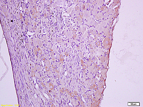 Formalin-fixed and paraffin embedded: rat spinal cord tissue labeled with Anti-Dnmt-3-beta Polyclonal Antibody (bs-0301R), Unconjugated at 1:600, followed by conjugation to the secondary antibody and DAB staining