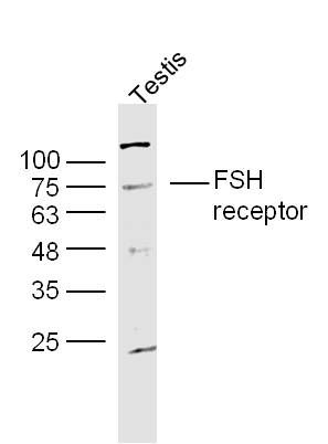 Lane 1: Mouse Testis; Probed with FSH Receptor Polyclonal Antibody, unconjugated (bs-0895R) at 1:300 overnight at 4\u00b0C followed by a conjugated secondary antibody for 60 minutes at 37\u00b0C.
