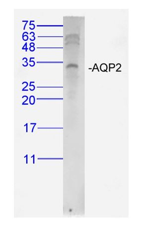 Lane 1: 293T Cells; Probed with AQP2 Polyclonal Antibody, unconjugated (bs-0261R) at 1:1000 overnight at 4°C followed by a conjugated secondary antibody for 60 minutes at 37°C.