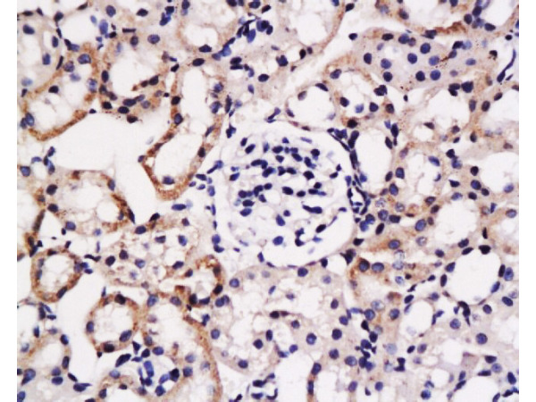 Formalin-fixed and paraffin embedded: rat kidney tissue labeled with Anti-fg-12 Polyclonal Antibody (bs-0315R), Unconjugated at 1:200, followed by conjugation to the secondary antibody and DAB staining