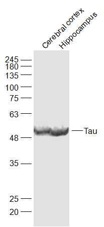 Lane 1: Rat Cerebral Cortex; Lane 2: Rat Hippocampus; 40ug loaded in each lane; Probed with Tau Polyclonal Antibody, unconjugated (bs-20443R) at 1:1000 overnight at 4\u00b0C followed by a conjugated secondary antibody for 60 minutes at 37\u00b0C.