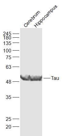 Lane 1: Mouse Cerebrum; Lane 2: Mouse Hippocampus; 40ug loaded in each lane; Probed with Tau Polyclonal Antibody, unconjugated (bs-20443R) at 1:1000 overnight at 4\u00b0C followed by a conjugated secondary antibody for 60 minutes at 37\u00b0C.