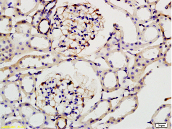 Formalin-fixed and paraffin embedded: rat kidney tissue labeled with Anti-ILK-1 Polyclonal Antibody (bs-0317R), Unconjugated at 1:200, followed by conjugation to the secondary antibody and DAB staining