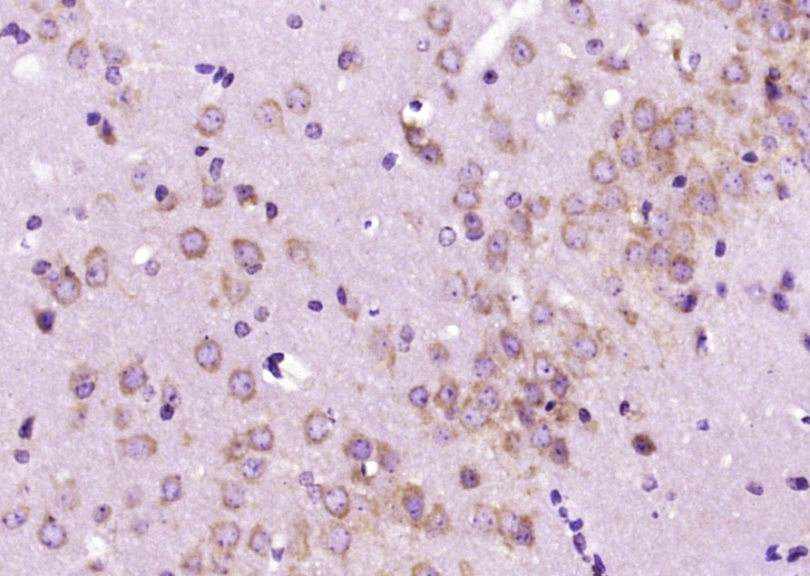 Paraformaldehyde-fixed, paraffin embedded Mouse brain; Antigen retrieval by boiling in sodium citrate buffer (pH6.0) for 15min; Block endogenous peroxidase by 3% hydrogen peroxide for 20 minutes; Blocking buffer (normal goat serum) at 37°C for 30min; Antibody incubation with DAT/Dopamine transporter Polyclonal Antibody, Unconjugated (bs-1714R) at 1:400 overnight at 4°C, DAB staining.