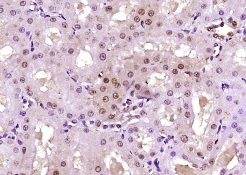 Paraformaldehyde-fixed, paraffin embedded Rat kidney; Antigen retrieval by boiling in sodium citrate buffer (pH6.0) for 15min; Block endogenous peroxidase by 3% hydrogen peroxide for 20 minutes; Blocking buffer (normal goat serum) at 37°C for 30min; Antibody incubation with SCP3 Polyclonal Antibody, Unconjugated (bs-3509R) at 1:400 overnight at 4°C, DAB staining.