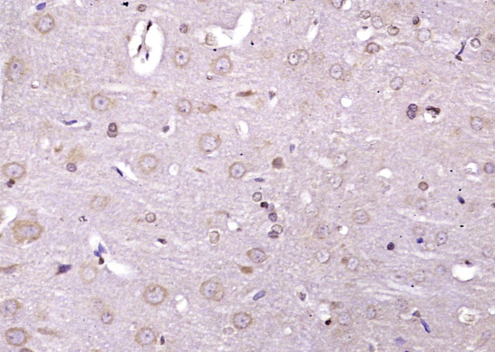 Paraformaldehyde-fixed, paraffin embedded Rat brainy; Antigen retrieval by boiling in sodium citrate buffer (pH6.0) for 15min; Block endogenous peroxidase by 3% hydrogen peroxide for 20 minutes; Blocking buffer (normal goat serum) at 37°C for 30min; Antibody incubation with IRE1a (Ser726) Polyclonal Antibody, Unconjugated (bs-4308R) at 1:400 overnight at 4°C, DAB staining.