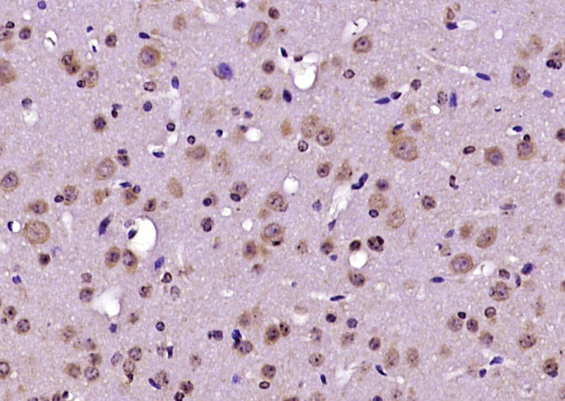 Paraformaldehyde-fixed, paraffin embedded Mouse brain; Antigen retrieval by boiling in sodium citrate buffer (pH6.0) for 15min; Block endogenous peroxidase by 3% hydrogen peroxide for 20 minutes; Blocking buffer (normal goat serum) at 37°C for 30min; Antibody incubation with RABGAP1 Polyclonal Antibody, Unconjugated (bs-7826R) at 1:400 overnight at 4°C, DAB staining.