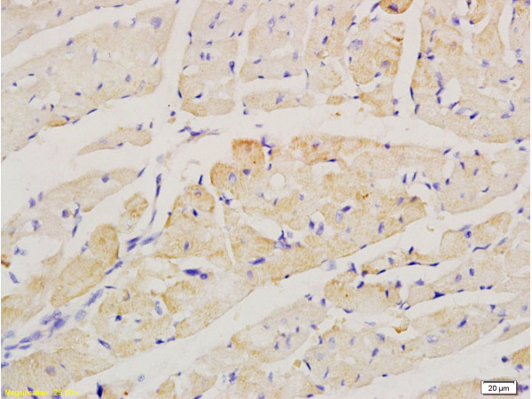 Formalin-fixed and paraffin embedded rat heart labeled with Anti-factor V Polyclonal Antibody, Unconjugated (bs-1040R) at 1:200 followed by conjugation to the secondary antibody and DAB staining.