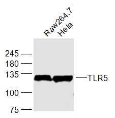 Lane 1: Mouse Raw264.7 Cells; Lane 2: Human Hela Cells; 30ug loaded in each lane; Probed with TLR5 Polyclonal Antibody, unconjugated (bs-1197R) at 1:1000 overnight at 4°C followed by a conjugated secondary antibody for 60 minutes at 37°C. Lane 1: Mouse Raw264.7 Cells; Lane 2: Human Hela Cells; 30ug loaded in each lane; Probed with TLR5 Polyclonal Antibody, unconjugated (bs-1197R) at 1:1000 overnight at 4°C followed by a conjugated secondary antibody for 60 minutes at 37°C.