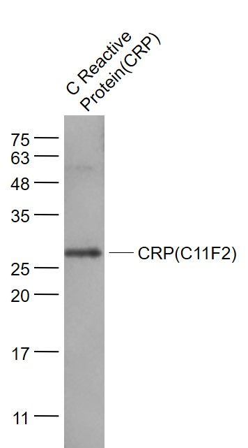 Lane 1: C Reactive Protein (CRP); 40ug loaded into the lane; Probed with CRP (C11F2) Monoclonal Antibody, unconjugated (bsm-0391M) at 1:1000 overnight at 4°C followed by a conjugated secondary antibody for 60 minutes at 37°C.