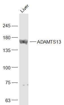 Lane 1: Mouse Liver; 40ug loaded into the lane; Probed with ADAMTS13 Polyclonal Antibody, unconjugated (bs-5856R) at 1:1000 overnight at 4°C followed by a conjugated secondary antibody for 60 minutes at 37°C. Lane 1: Mouse Liver; 40ug loaded into the lane; Probed with ADAMTS13 Polyclonal Antibody, unconjugated (bs-5856R) at 1:1000 overnight at 4°C followed by a conjugated secondary antibody for 60 minutes at 37°C.