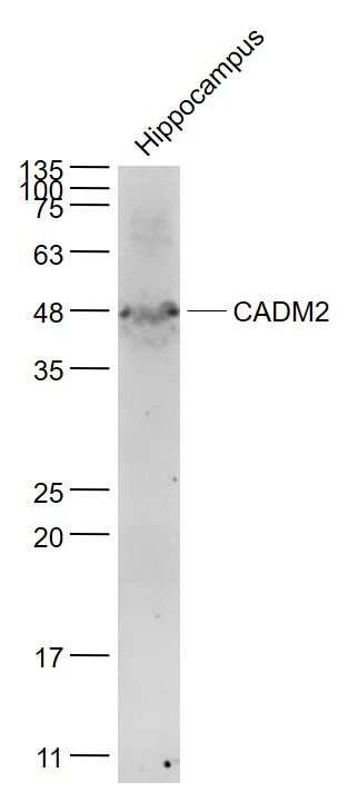 Lane 1: Mouse Hippocampus; 40ug loaded into the lane; Probed with CADM2 Polyclonal Antibody, unconjugated (bs-8246R) at 1:1000 overnight at 4°C followed by a conjugated secondary antibody for 60 minutes at 37°C.
