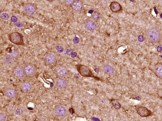 Paraformaldehyde-fixed, paraffin-embedded Rat brain; Antigen retrieval by boiling in sodium citrate buffer (pH6.0) for 15min; Block endogenous peroxidase by 3% hydrogen peroxide for 20 minutes; Blocking buffer (normal goat serum) at 37°C for 30min; Antibody incubation with Kisspeptin Polyclonal Antibody, Unconjugated (bs-0749R) at 1:400 overnight at 4°C, followed by secondary and DAB staining.