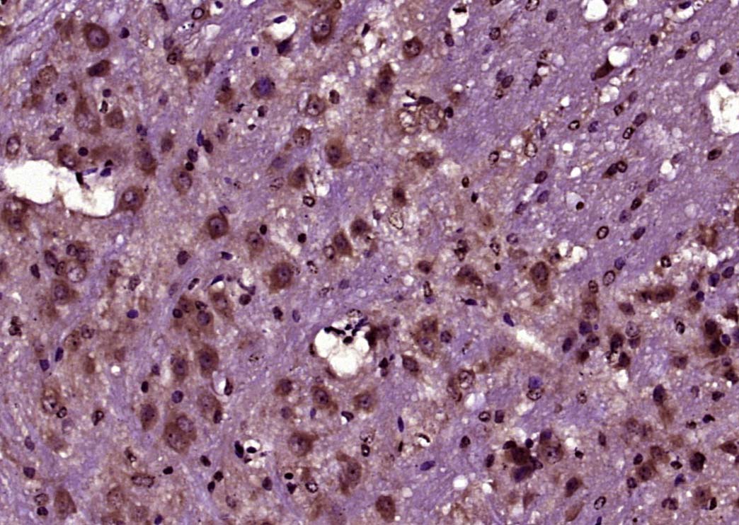 Paraformaldehyde-fixed, paraffin embedded Mouse brain; Antigen retrieval by boiling in sodium citrate buffer (pH6.0) for 15min; Block endogenous peroxidase by 3% hydrogen peroxide for 20 minutes; Blocking buffer (normal goat serum) at 37°C for 30min; Antibody incubation with CEMIP Polyclonal Antibody, Unconjugated (bs-8059R) at 1:400 overnight at 4°C, followed by secondary and DAB staining. Paraformaldehyde-fixed, paraffin embedded Mouse brain; Antigen retrieval by boiling in sodium citrate buffer (pH6.0) for 15min; Block endogenous peroxidase by 3% hydrogen peroxide for 20 minutes; Blocking buffer (normal goat serum) at 37°C for 30min; Antibody incubation with CEMIP Polyclonal Antibody, Unconjugated (bs-8059R) at 1:400 overnight at 4°C, followed by secondary and DAB staining.