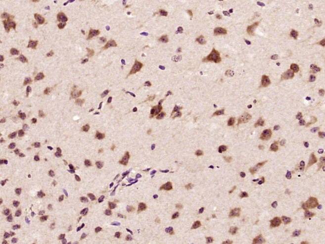Paraformaldehyde-fixed, paraffin-embedded Mouse brain tissue; Antigen retrieval by boiling in sodium citrate buffer (pH6.0) for 15min; Block endogenous peroxidase by 3% hydrogen peroxide for 20 minutes; Blocking buffer (normal goat serum) at 37°C for 30min; Antibody incubation with CARM1 Polyclonal Antibody, Unconjugated (bs-4098R) at 1:400 overnight at 4°C, followed by secondary and DAB staining.