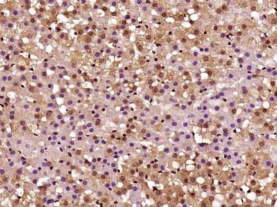 Paraformaldehyde-fixed, paraffin-embedded Rat Adrenal Gland tissue; Antigen retrieval by boiling in sodium citrate buffer (pH6.0) for 15min; Block endogenous peroxidase by 3% hydrogen peroxide for 20 minutes; Blocking buffer (normal goat serum) at 37°C for 30min; Antibody incubation with CARM1 Polyclonal Antibody, Unconjugated (bs-4098R) at 1:400 overnight at 4°C, followed by secondary and DAB staining.