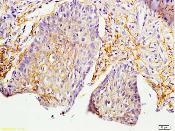 Formalin-fixed and paraffin embedded rat skin labeled with Anti-MIF Polyclonal Antibody, Unconjugated (bs-1044R) at 1:200 followed by conjugation to the secondary antibody and DAB staining.
