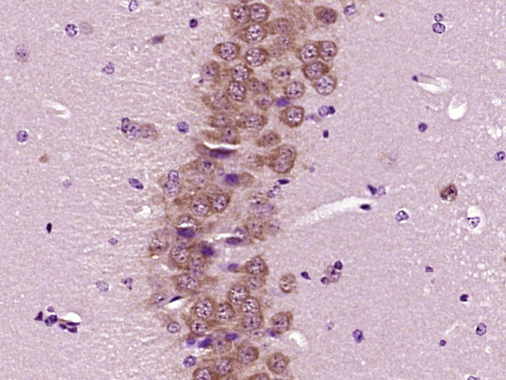 Paraformaldehyde-fixed, paraffin embedded Mouse brain; Antigen retrieval by boiling in sodium citrate buffer (pH6.0) for 15min; Block endogenous peroxidase by 3% hydrogen peroxide for 20 minutes; Blocking buffer (normal goat serum) at 37°C for 30min; Antibody incubation with FOX3/NeuN Polyclonal Antibody, Unconjugated (bs-1613R) at 1:400 overnight at 4°C, DAB staining.