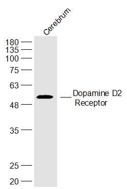 Rat Cerebrum lysates probed with Dopamine D2 Receptor Polyclonal Antibody, Unconjugated (bs-20729R) at 1:300 dilution and 4˚C overnight incubation. Followed by conjugated secondary antibody incubation at 1:20000 for 60 min at 37˚C.